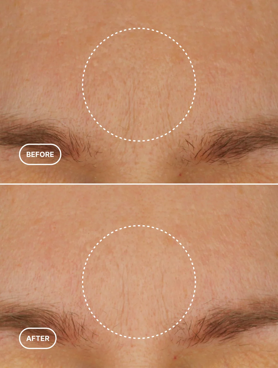 Mitrinošs krēms ar retinola alternatīvu